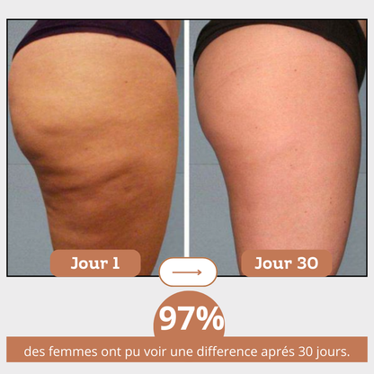 Rouleau de massage Anti-cellulite
