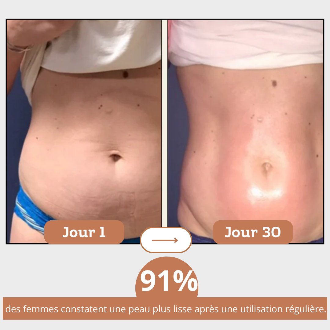 Rouleau de massage Anti-cellulite